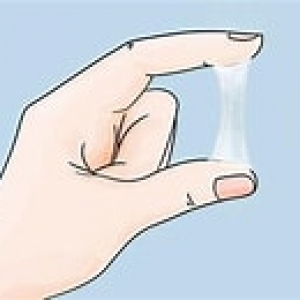 Bệnh huyết trắng do vi khuẩn: Viêm âm đạo thường thấy ở phụ nữ 