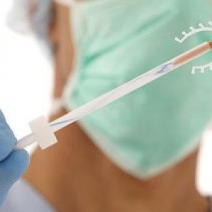 Phụ nữ bị viêm lộ tuyến đặt vòng tránh thai được không?